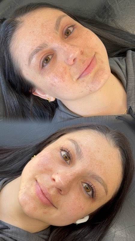 Before and after brows
